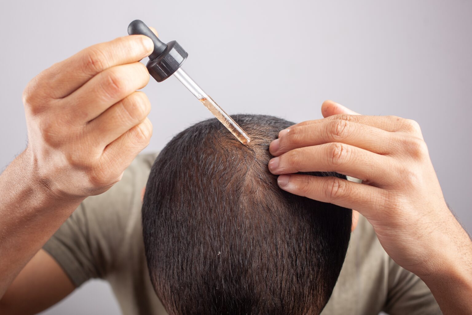 When And How To Use Minoxidil Rogaine After A Hair Transplant