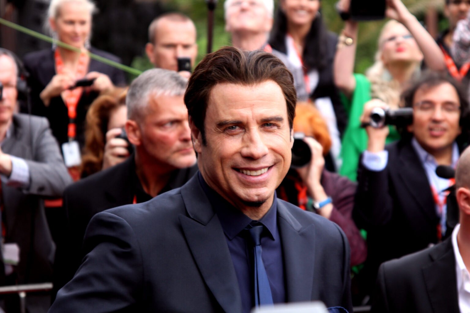 Did John Travolta Get A Hair Transplant Expert Reveals All