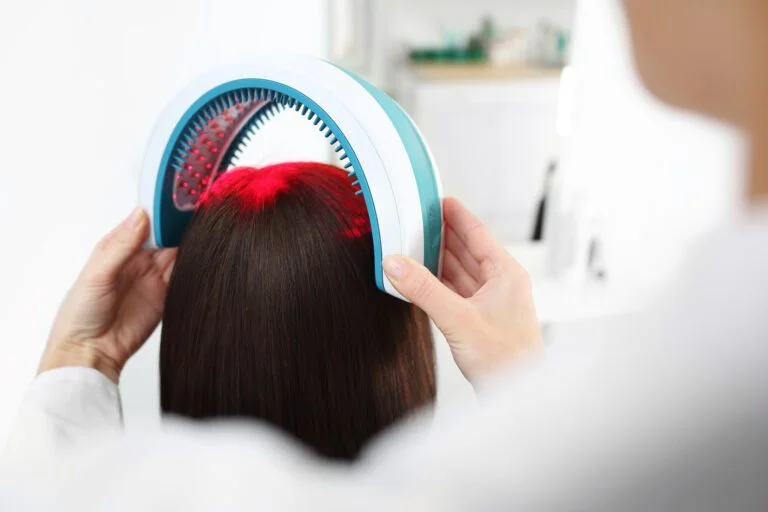 LLLT para a queda de cabelo