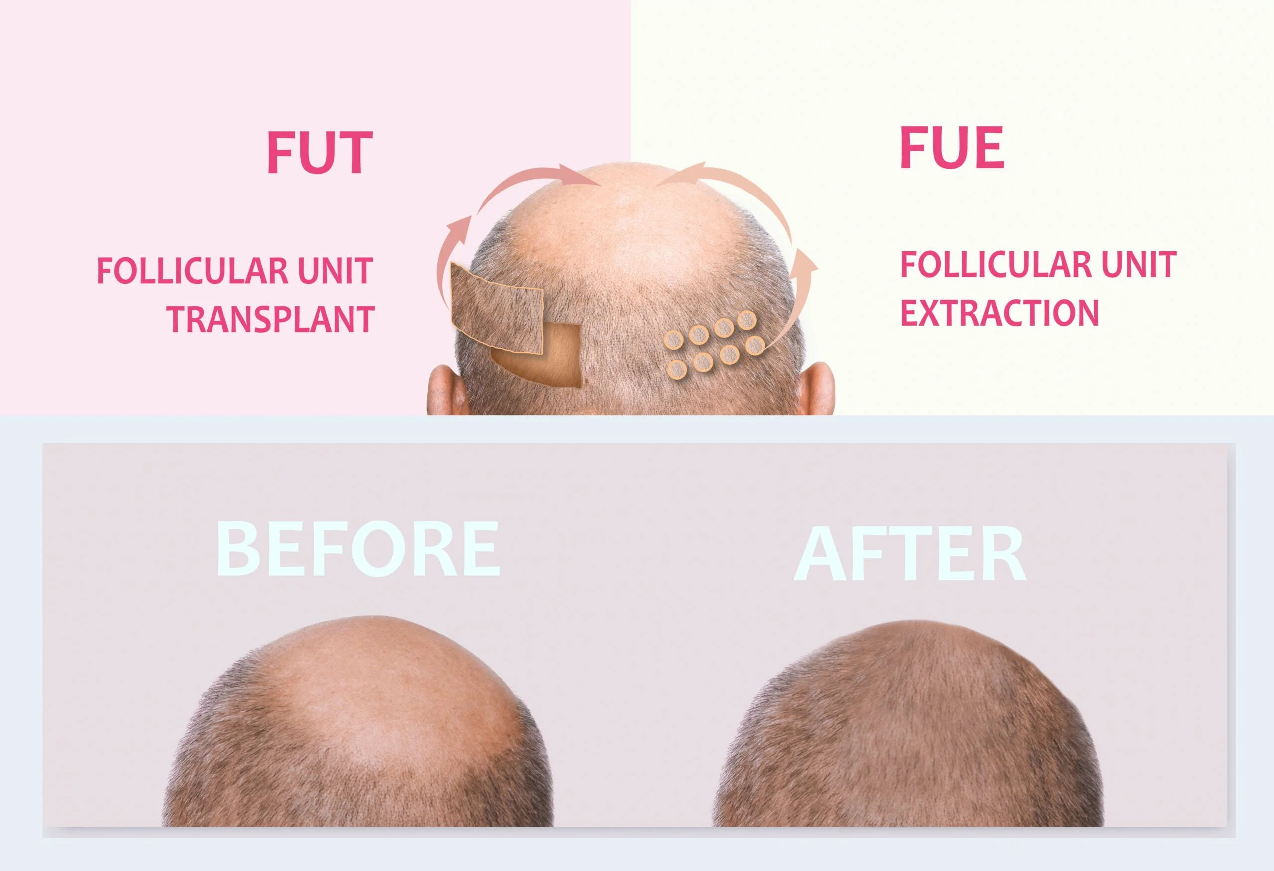 fue vs fut scaled
