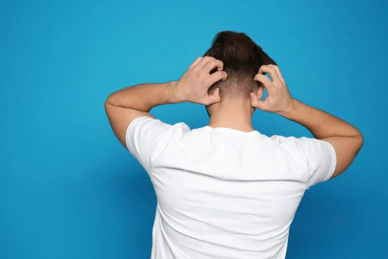 Infections liées à la greffe de cheveux : Causes et prévention