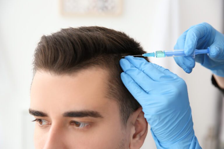 Hair Transplant Recovery & Aftercare: Tips For Best Results 4 Hair Transplant Recovery & Aftercare: Tips For Best Results