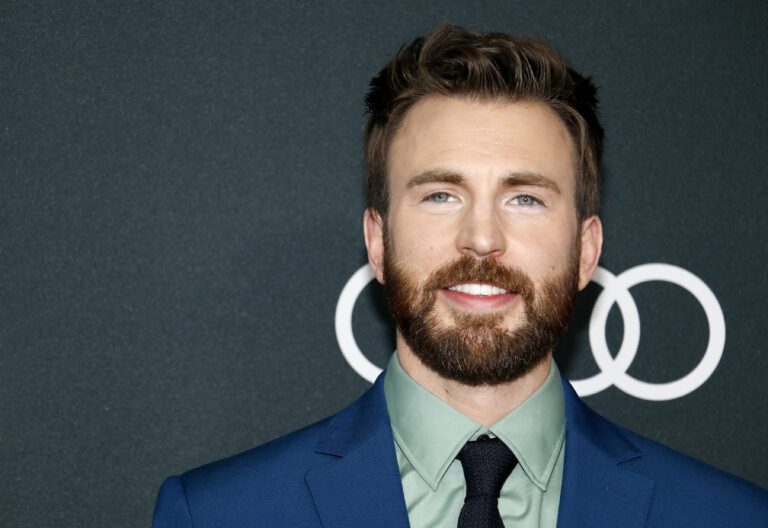 ¿Se ha hecho Chris Evans un trasplante de pelo? Experto revela todo 6 chris evans' trasplante capilar