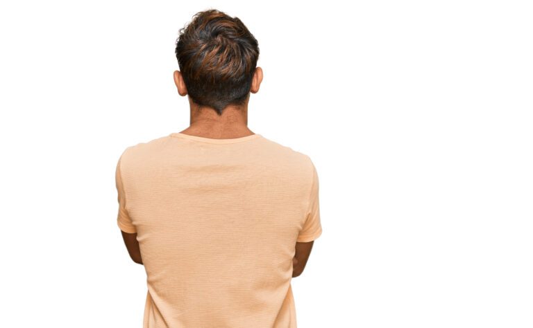 The Donor Area for Hair Transplants: What You Need to Know 7 hair transplant donor areas