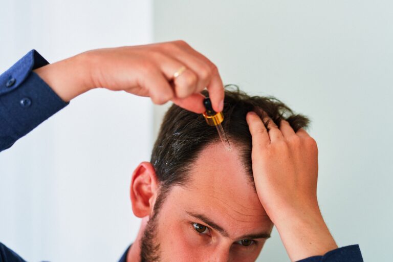Topical Finasteride: Does It Work and How It Compares to Oral Tablets? 3 does topical finasteride work?