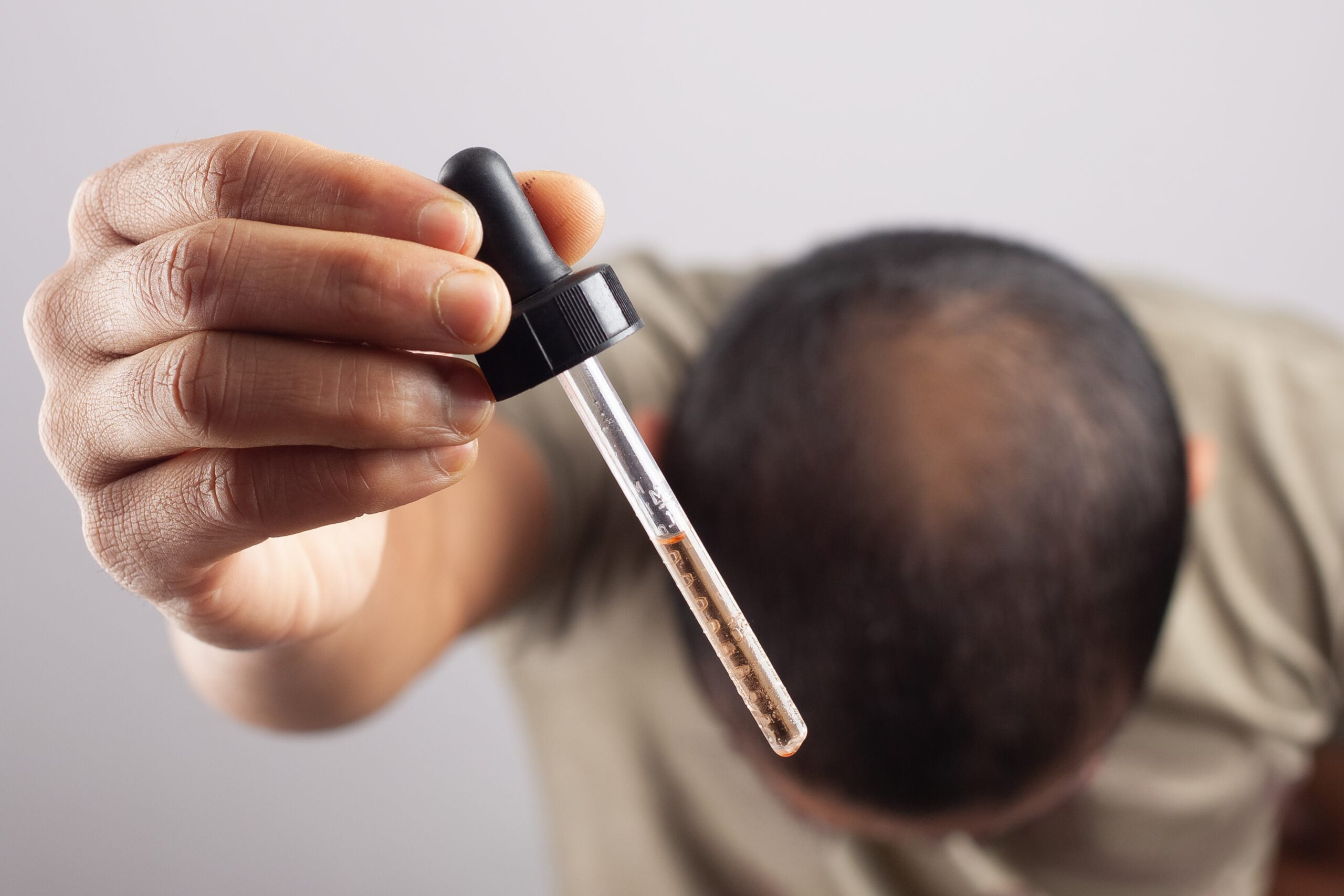 10 Produk Minoxidil Terbaik Untuk Pertumbuhan Rambut Pria (2024) 1 seorang pria memegang alat penetes yang penuh dengan minoxidil