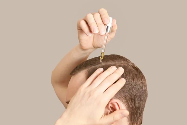Homme appliquant du finastéride sur les cheveux