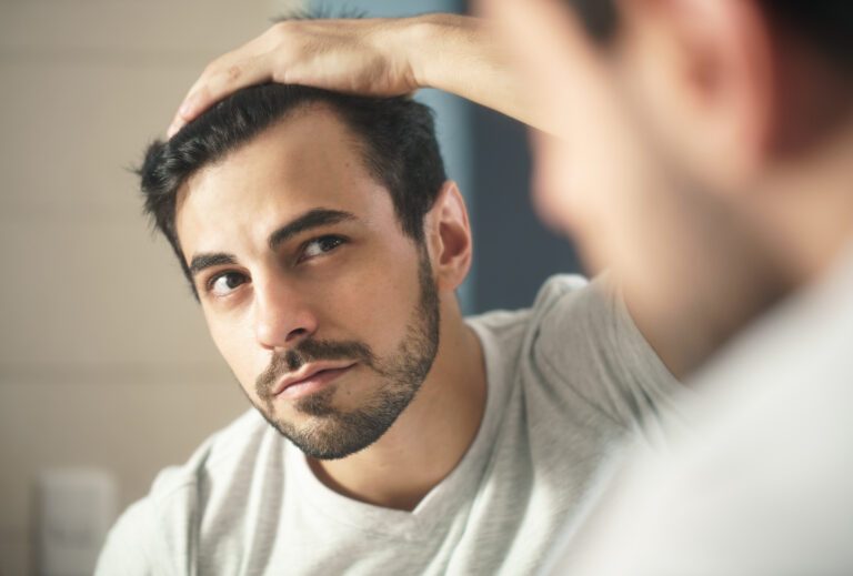 Can Minoxidil (Rogaine) Fix Your Receding Hairline & Bald Patch? 5 Young man checking his hairline
