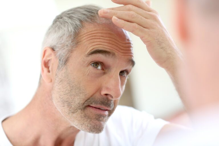 How Do Minoxidil & Rogaine Work To Regrow Hair? 4 Man inspecting his hairline