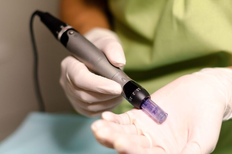 Is There Any Difference Between Microneedling & Dermarolling? 7 Person holding a micro pen