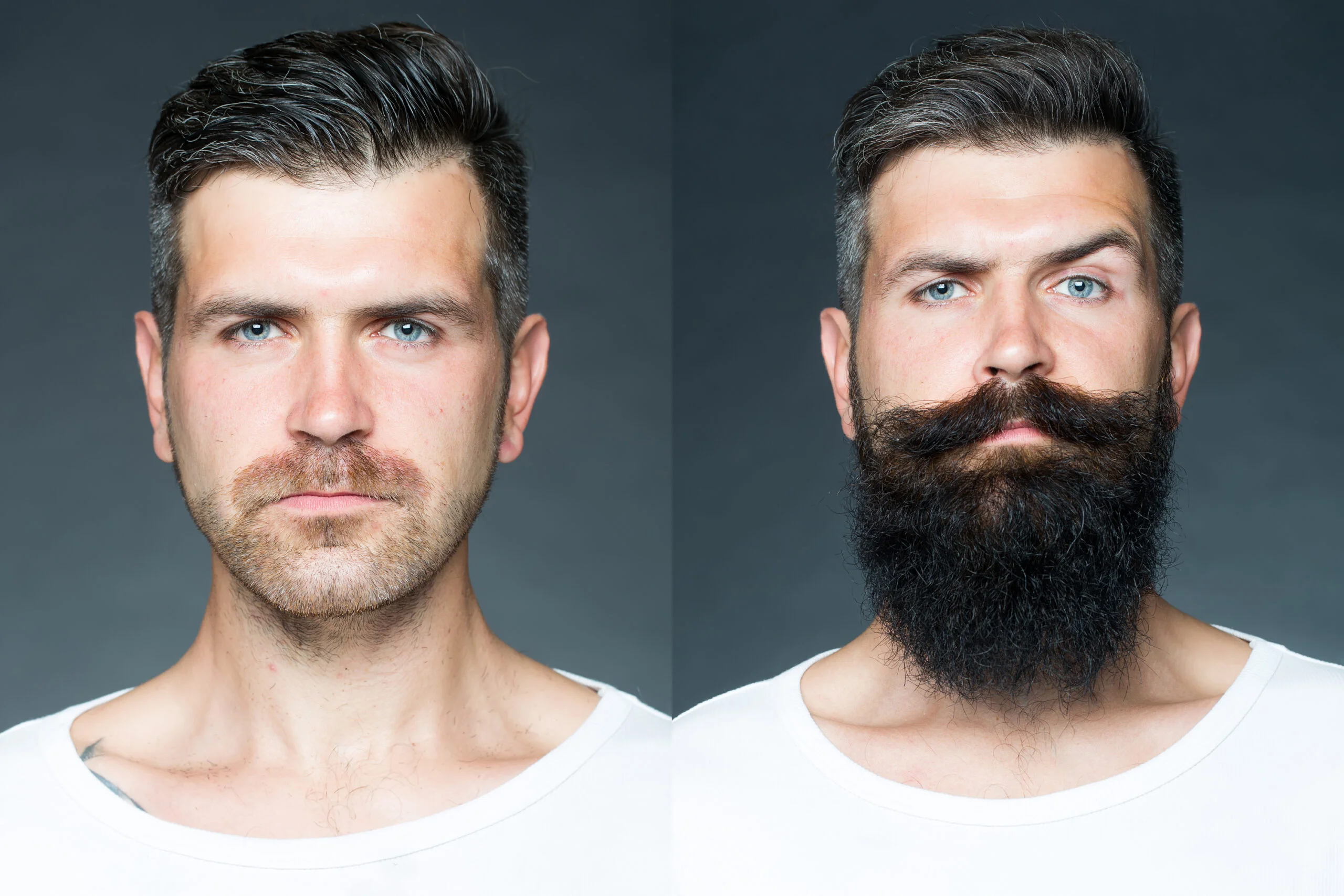 Man with less beard before and more after