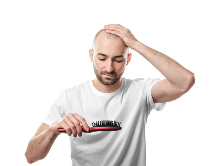 Can Minoxidil Cause Hair Loss? The Shedding Phase Explained 8 man holding his hair and a comb