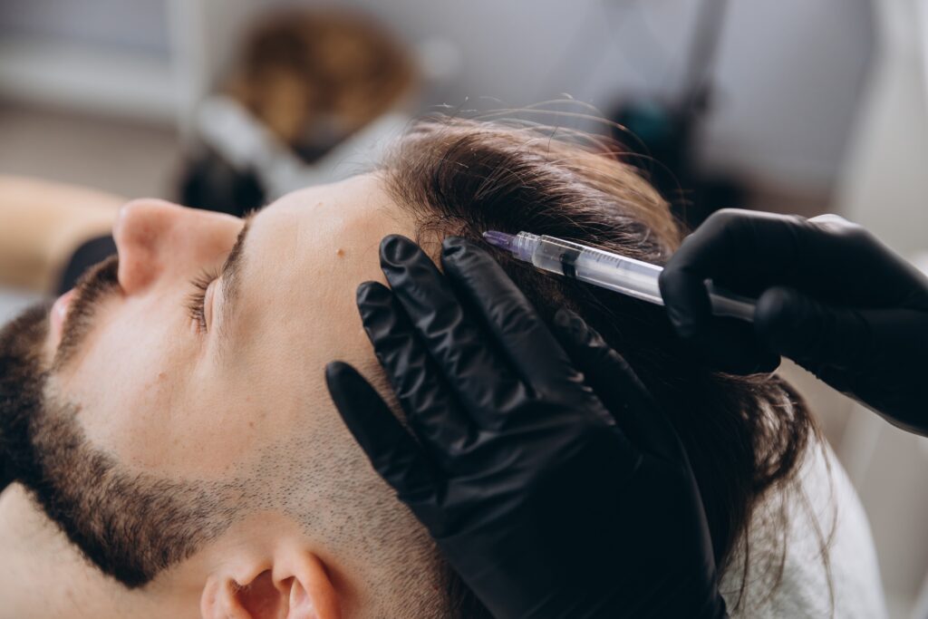 Todo lo que debe saber sobre la mesoterapia capilar 4 hombre recibiendo inyecciones de mesoterapia