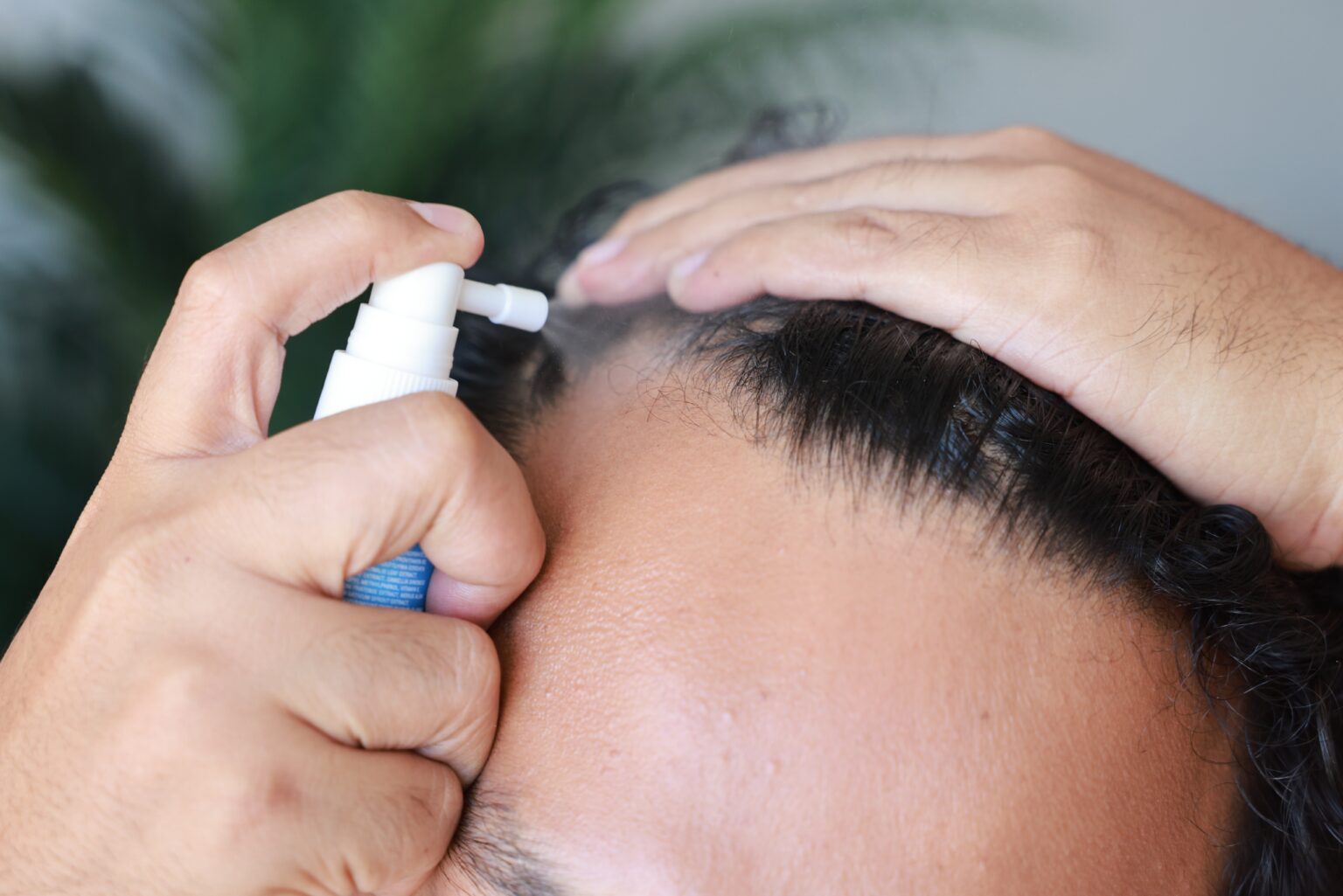 Ru58841 For Hair Loss Effectiveness Side Effects And Doses Ru58841 For Hair Loss Effectiveness Side Effects And Doses